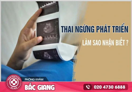 Điều trị thai ngưng phát triển kịp thời, hạn chế biến chứng