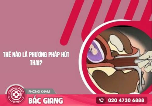 Hút thai là gì? Quy trình hút thai diễn ra như thế nào
