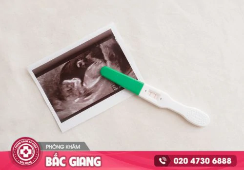 Chi phí phá thai 1 tháng tuổi hiện nay là bao nhiêu?