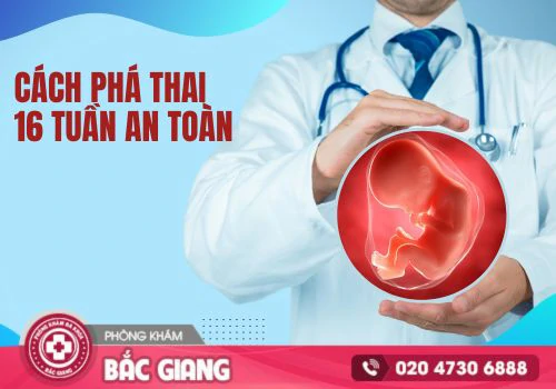 phá thai 16 tuần