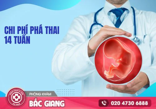 Chi phí phá thai 14 tuần bao nhiêu tiền?