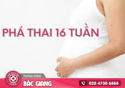 Phá thai 16 tuần bao nhiêu tiền?