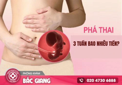 Chi phí phá thai 3 tuần bao nhiêu tiền hiện nay?
