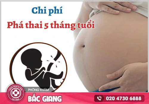Tư vấn chi phí phá thai 5 tháng