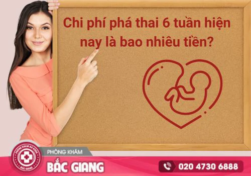 Chi phí phá thai 6 tuần hiện nay là bao nhiêu tiền?
