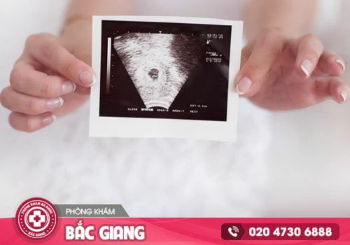 Chi phí phá thai 8 tuần bao nhiêu tiền?