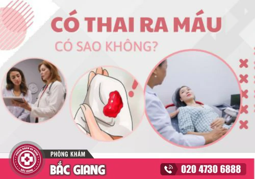 Có thai ra máu có sao không? Có phải đã sảy thai?