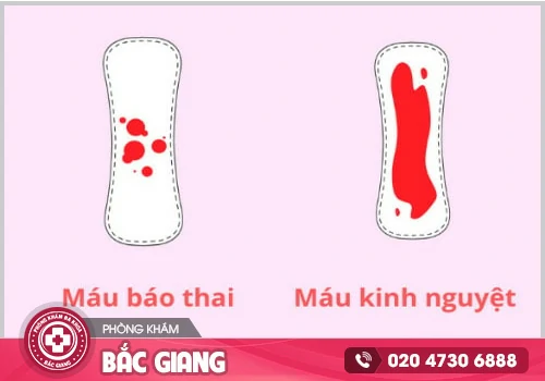 Các dấu hiệu mang thai tự nhiên bạn có thể nhận biết