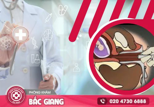 Hút thai an toàn bằng phương pháp hút thai chân không