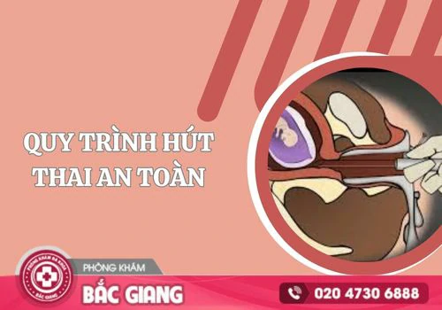 Tìm hiểu quy trình hút thai an toàn – Những điều chị em cần biết