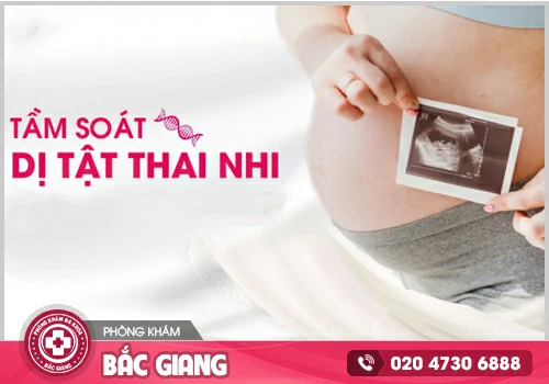 Khám thai dị tật Sớm có hướng xử lý kịp thời
