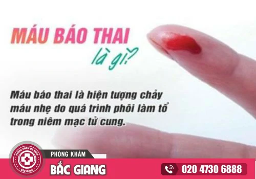 Chuyên gia sản khoa giải thích hiện tượng máu báo thai và cách xử lý an toàn