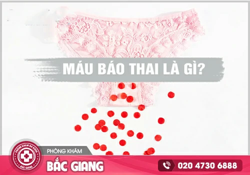 Máu báo thai là gì? Cần làm gì khi có dấu hiệu này?