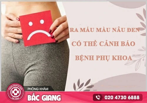 Máu báo thai nâu đen có phải hiện tượng bình thường không?