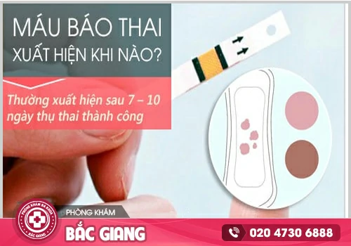 Máu báo thai xuất hiện khi nào tránh nhầm với ngày đèn đỏ