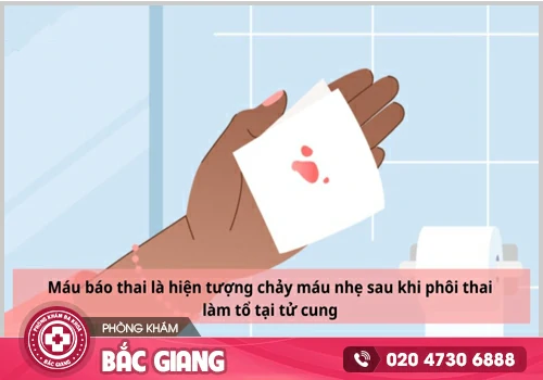 Máu báo thai xuất hiện khi nào tránh nhầm với ngày đèn đỏ