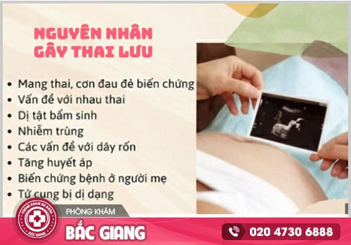 Nguyên nhân thai lưu - Mẹ bầu nên làm gì để đảm bảo an toàn cho sức khoẻ?