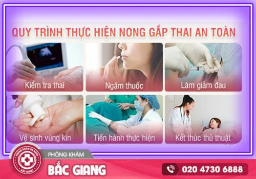 phá thai 4 tháng