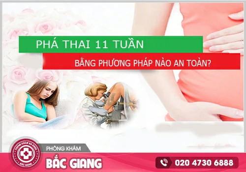 Phá thai 11 tuần như thế nào? Tư vấn phá thai an toàn hiệu quả