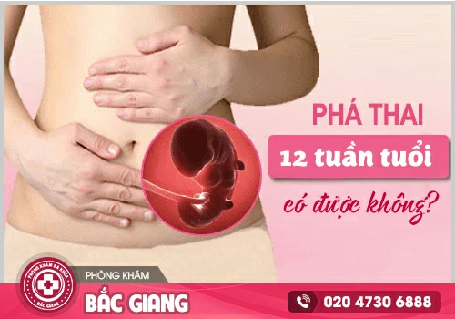 Phá thai 12 tuần tuổi bằng cách nào? Hết bao nhiêu tiền?