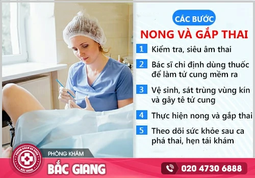 Mang thai 17 tuần có phá được không?