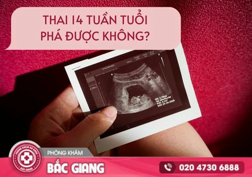 Thai 14 tuần tuổi phá được không? phá thai 14 tuần