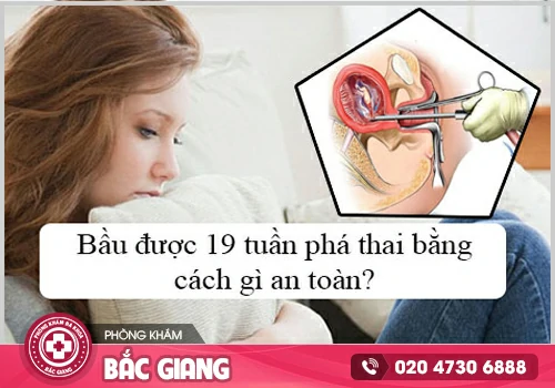 Cập nhật phương pháp phá thai 19 tuần an toàn