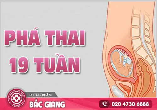 Phá thai 19 tuần có nguy hiểm không?