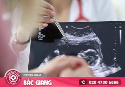 Phá thai 20 tuần bao nhiêu tiền?