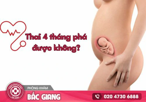 Phá thai 4 tháng có được không? Tư vấn đình chỉ thai an toàn