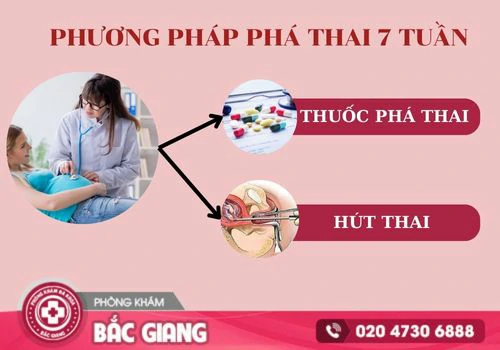 chi phí phá thai 7 tuần