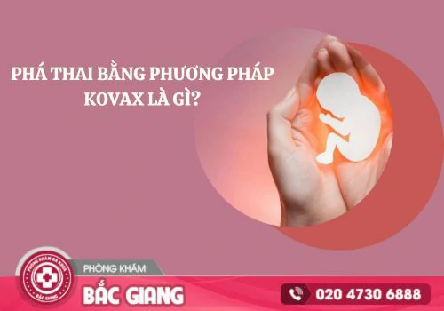 phá thai bằng phương pháp kovax