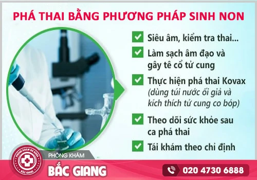 Sinh non - Kỹ thuật phá thai an toàn chuyên dành cho thai lớn