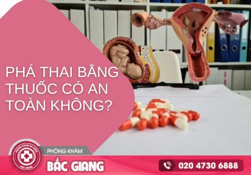 Phá thai bằng thuốc có an toàn không?