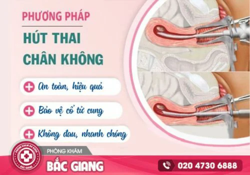 phương pháp hút thai chân không