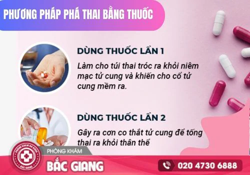 thai 1 tháng có bỏ được không