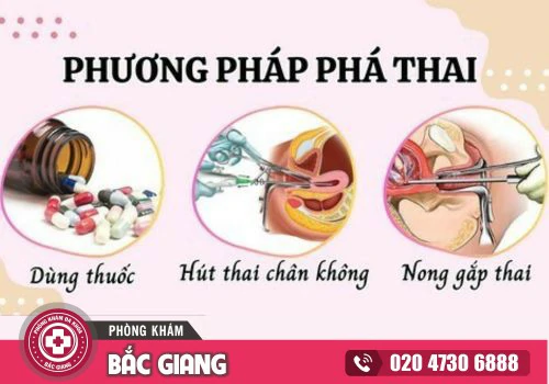 Những phương pháp phá thai an toàn ít đau, hạn chế khả năng sót thai