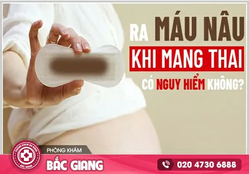 Máu nâu có thai có phải là triệu chứng cảnh báo bệnh lý?