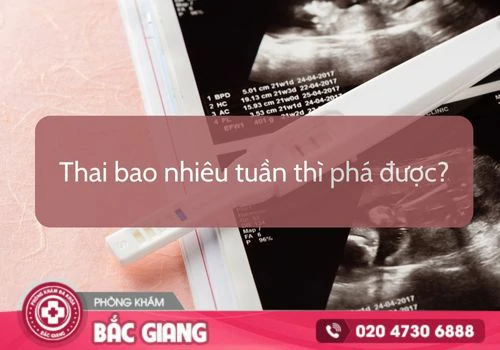 Thai bao nhiêu tuần thì phá được? Địa chỉ phá thai uy tín