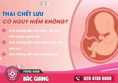Thai Lưu Có Nguy Hiểm Không? Dấu Hiệu Và Biện Pháp Xử Lý Khi Bị Thai Lưu