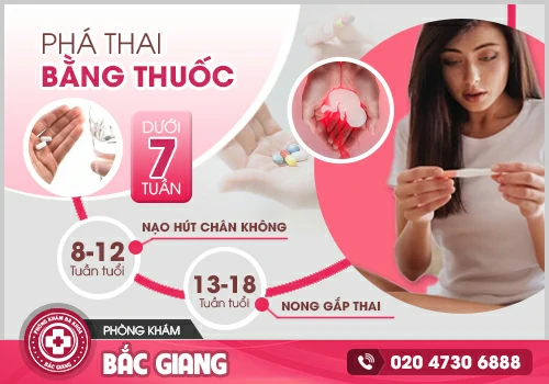 Mang thai 17 tuần có phá được không?