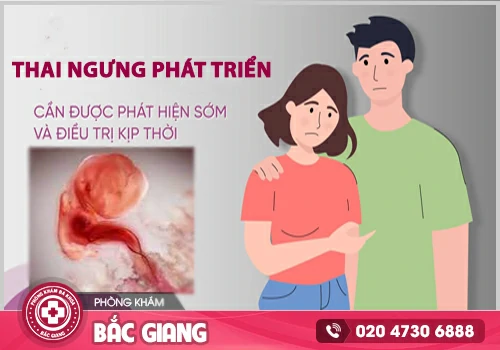 Nguyên nhân thai không phát triển - Cách xử lý kịp thời, tránh biến chứng