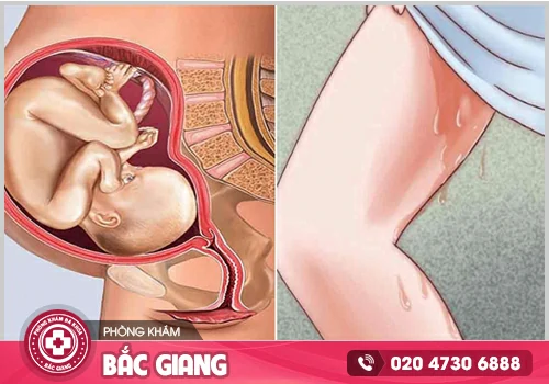 Điều trị thai ngưng phát triển kịp thời, hạn chế biến chứng