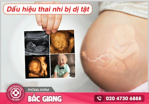 Siêu âm thai dị tật nhanh chóng phát hiện và xử lý kịp thời