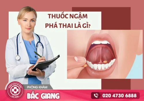 thuốc ngậm phá thai