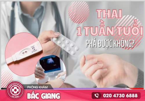 Phá thai 1 tuần bằng thuốc có được không?