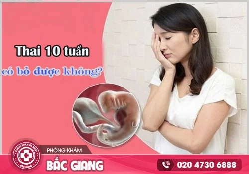 Thai 10 tuần phá bằng thuốc được không?
