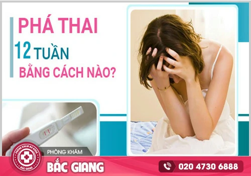 Thai 12 tuần có phá bằng thuốc được không?