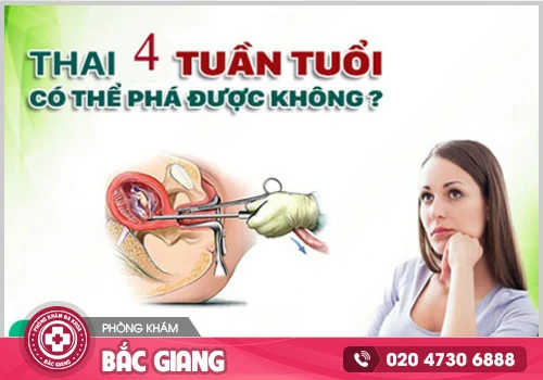 Thai 4 tuần tuổi phá bằng thuốc được không?