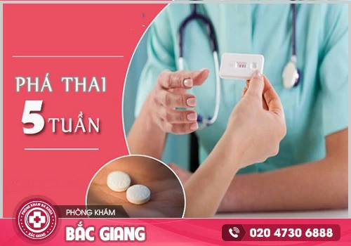 Phá thai 5 tuần bằng thuốc nên hay không nên?